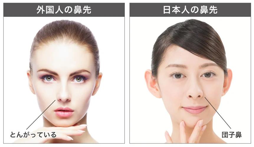 峯岸みなみの顔が変わったのは整形 歯並び 鼻 顎変わったところ比較 気になるマガジンdogyear