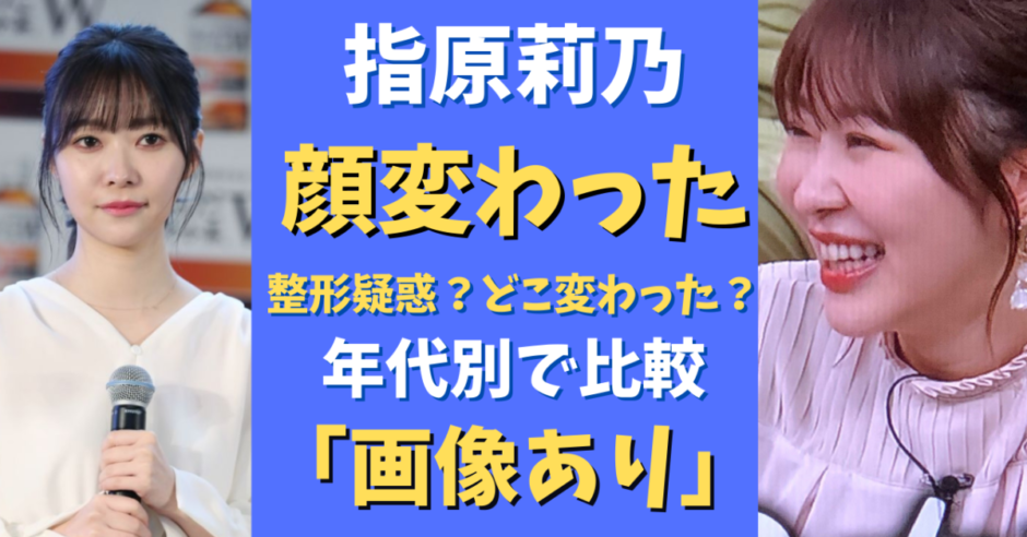 指原莉乃の顔の変化 整形疑惑は本当か 画像比較 気になるマガジンdogyear