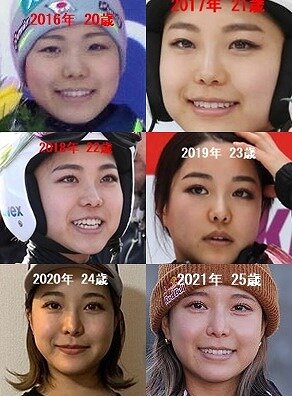 高梨沙羅の顔の変化を比較した画像