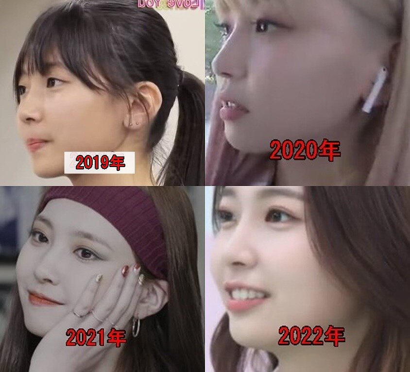 2019年～2022年5月までのNiziUマユカの鼻を比較した画像