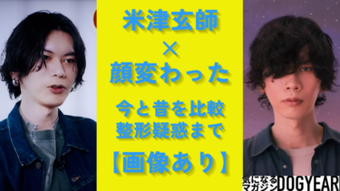 米津玄師の顔変わった！整形箇所：昔と今を画像比較