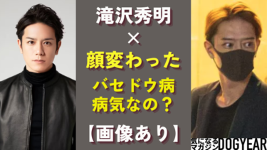 滝沢秀明の現在の姿（バセドウ病）顔変わった！病気と言われる理由まとめ