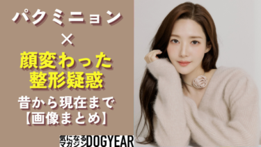 パクミニョンは昔の顔から変化あり！整形疑惑を画像で比較まとめ