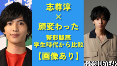 志尊淳の顔変わった！整形疑惑まで過去から比較してみる